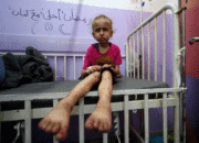 Penutupan Penyeberangan Rafah Memperburuk Krisis Kesehatan di Gaza